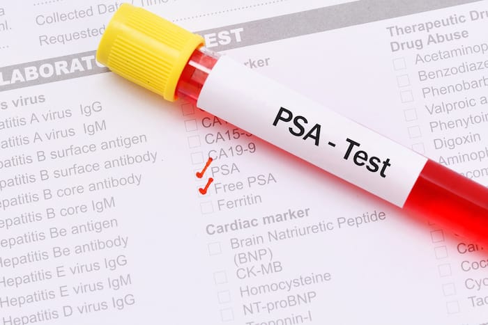 4 Reasons You Should Have a PSA (Prostate Cancer Screening Blood Test ...